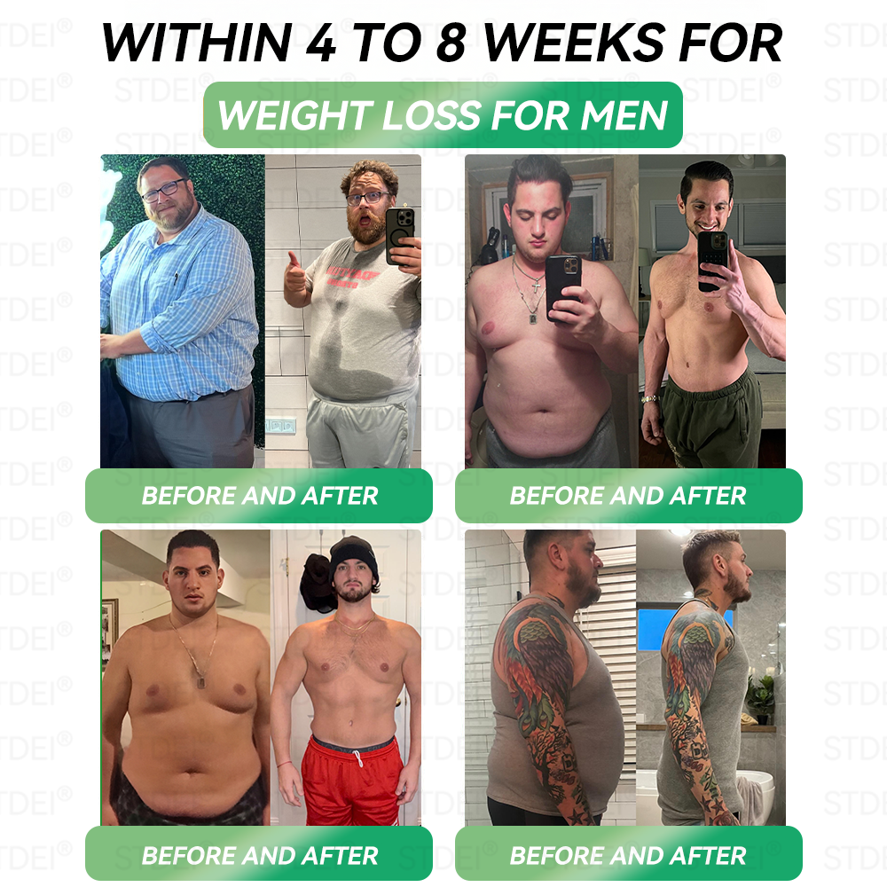 🔥Hot Sale🎁GLP-1 Microcapsule Burst Patch——👩⚕️A Breakthrough in Weight Loss and Blood Sugar Management💪