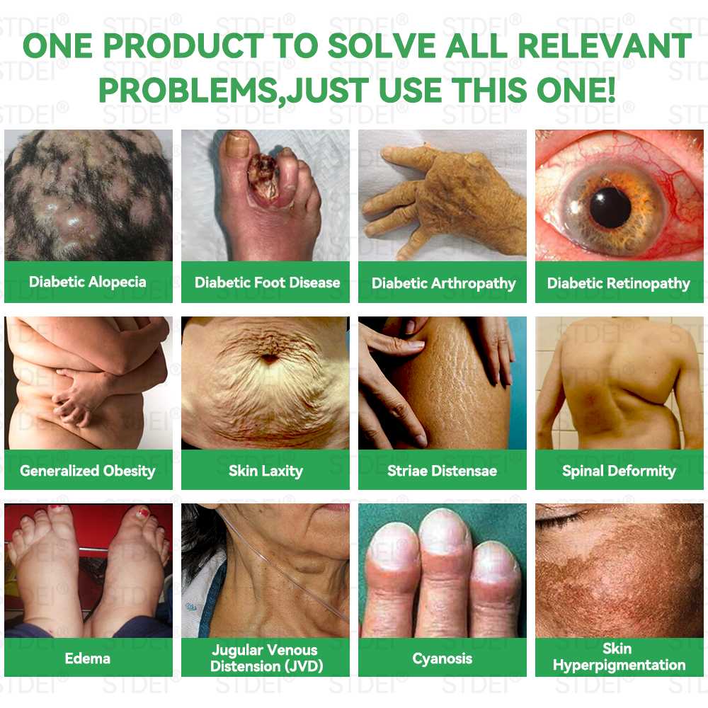 🔥Hot Sale🎁GLP-1 Microcapsule Burst Patch——👩⚕️A Breakthrough in Weight Loss and Blood Sugar Management💪