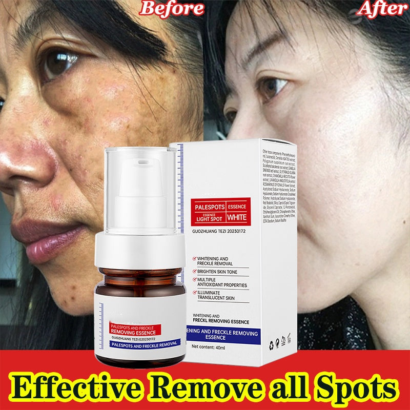 🔥Final 3 Hours – 50% OFF!🔥⚡5-second brightening rescue: Dark spots disappear, blemishes fade, and skin becomes radiant! Vitamin C Whitening Freckles