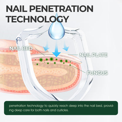 🔥Hot Sale 50% Off🎁Kreaint Nail Care Serum