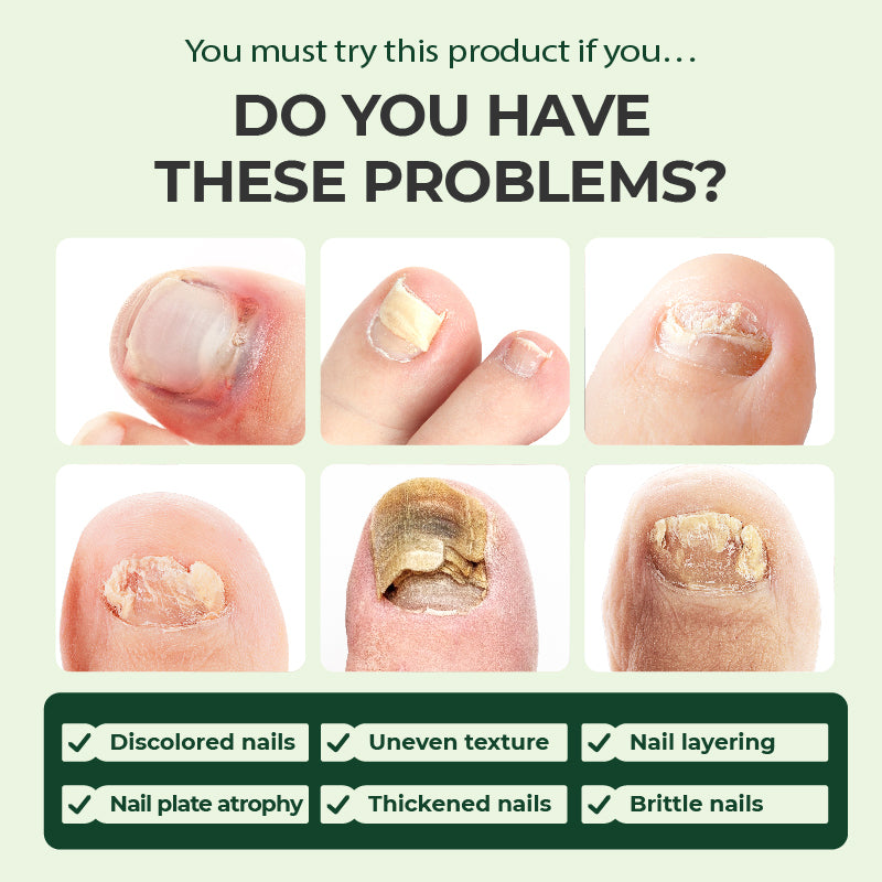 🔥Hot Sale 50% Off🎁Kreaint Nail Care Serum