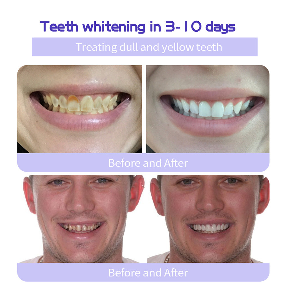 🔥Ends Tonight: Get 60% OFF Before It’s Gone!🎁 BBOJI™ Fluoride-Free Hydroxyapatite Toothpaste – Gentle Whitening & Enamel Strength for Sensitive Teeth