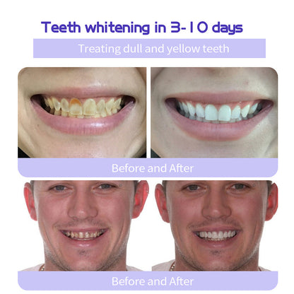 🔥Ends Tonight: Get 60% OFF Before It’s Gone!🎁 BBOJI™ Fluoride-Free Hydroxyapatite Toothpaste – Gentle Whitening & Enamel Strength for Sensitive Teeth