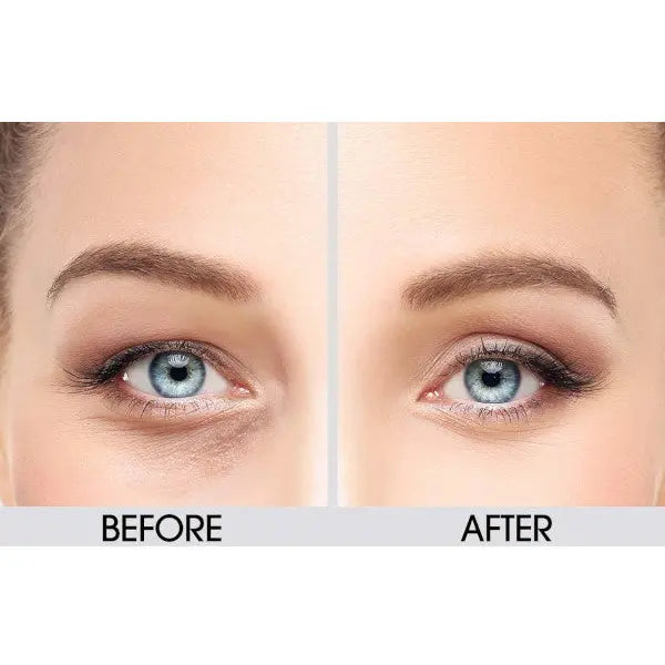 🔥Hot Sale 50% Off🎁Dermactin Anti-Aging Upper Eyelid Cream 1 oz.