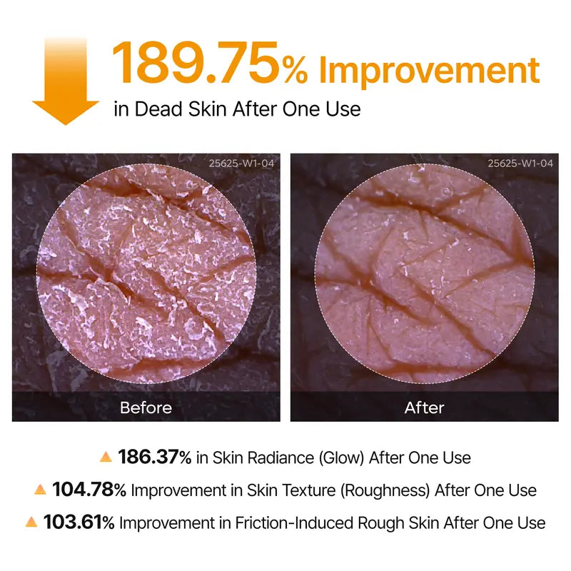 Black Friday Final 3 Hours 60% OFF!🔥Peel Shot Kojic & Turmeric Pore-Clearing Spray, Exfoliating Skin Repair