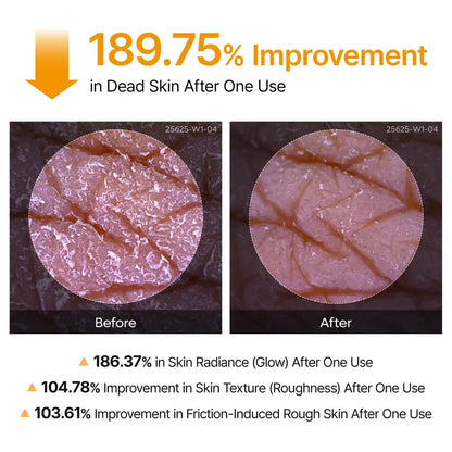 Black Friday Final 3 Hours 60% OFF!🔥Peel Shot Kojic & Turmeric Pore-Clearing Spray, Exfoliating Skin Repair
